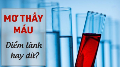 Nằm mơ thấy máu là điềm báo may hay xui? Con số trúng lớn